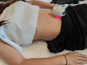 laser-treatment-toronto