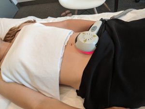 laser-for-fertility-toronto